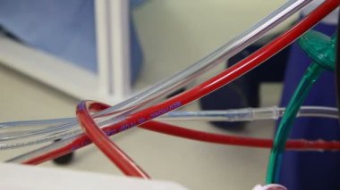 Vinnitsa, Ukrayna - Şubat 2018: cerrahlar takım operasyonda. Kalp ameliyatı. Ameliyatta çalışır.