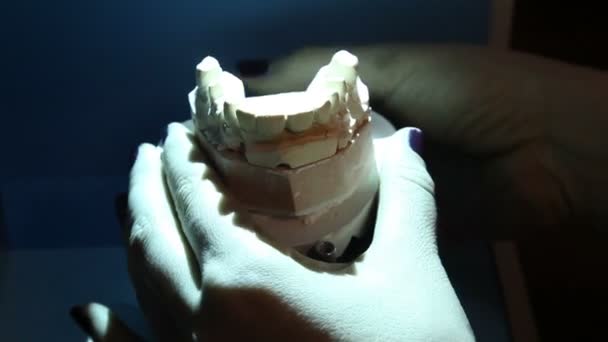 Escaneo Impresión Los Dientes Para Posterior Impresión Impresora Prótesis Dentales — Vídeo de stock