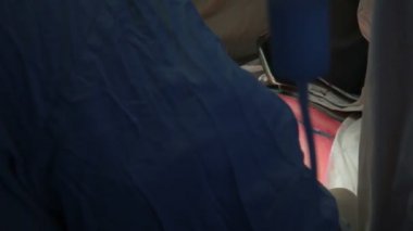 Onkoloji. Meme bezinin habis bir tümör çıkarılması. Meme implantı yüklendikten sonra bir kanserli tümör çıkarılması.