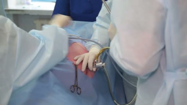 Removal Malignant Tumor Kidney Resection Kidney Surgeons Team Hands Laparoscopic — Stock Video