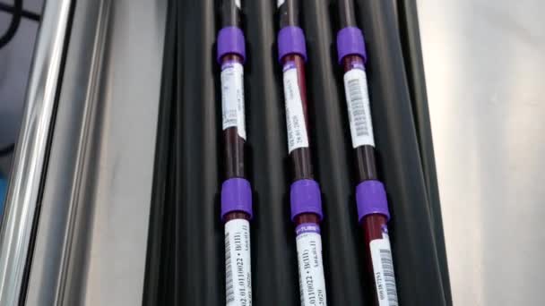 Winnica Ukraina Stycznia 2020 Centrum Krwiodawstwa Pobieranie Próbek Krwi Analizy — Wideo stockowe