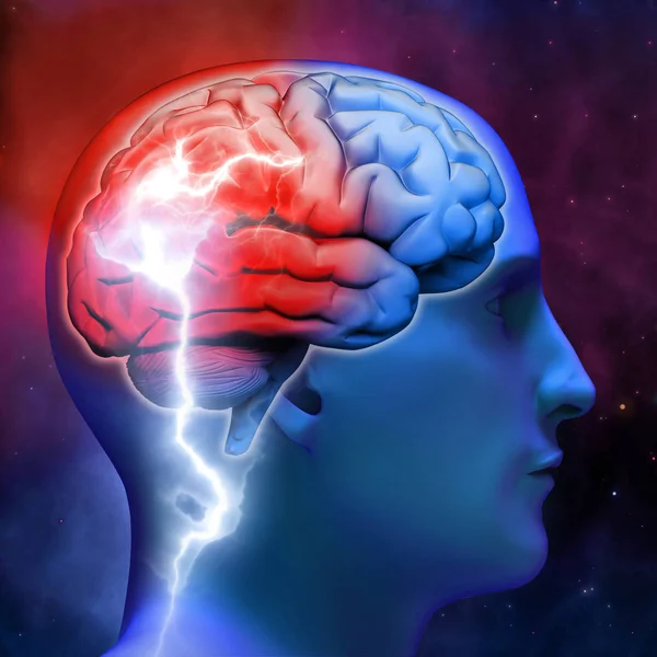 Een heldere flits in het menselijk brein. Neurologie en ziekte. Nervou — Stockfoto