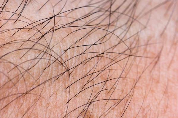 Closeup human skin with hair, macro — Stock Photo, Image