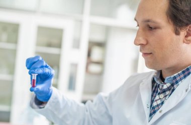 Örnek ile tüp bebek tutan erkek laborant