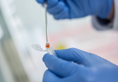 Laboratuvar teknisyeni kimya kaşıkla bir örnek almak