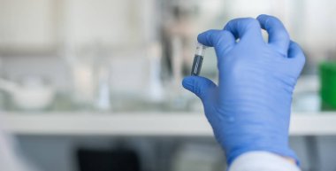 Örnek ile tüp bebek tutan laborant