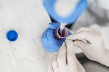 İki bilim adamları laboratuarda test tüpleri pipet ile doldurma