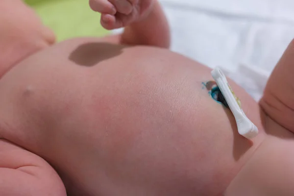 Recién nacido con abrazaderas de ombligo de plástico — Foto de Stock