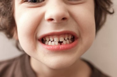 Çekici kıvırcık çocuk beyaz arka planda dişsiz gülümsüyor. Çocuk ilk süt dişini kaybetti. Sağlıklı diş konsepti, diş sağlığı kliniği.
