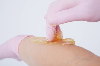 Eller lastik eldivenlerin içinde, yakın plan. Doktor ağda yaptırır, tatlım. Sıhhiye tüy dökülmesine hazırlanıyor. Tıp, sağlık, güzellik endüstrisi, saç kesimi, doğal malzeme kavramı. Boşluğu kopyala