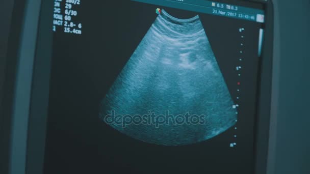 Primer plano de la mujer que recibe una ecografía en el abdomen por el médico — Vídeos de Stock