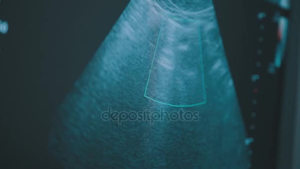 Obrazovka z echo-na odbornou echokardiografii Ultrazvukový přístroj. — Stock video