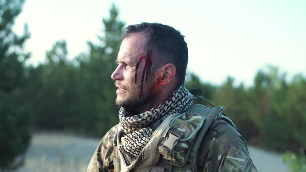 Раненый солдат смотрит в сторону — стоковое фото