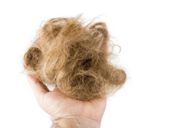 saç fırçasından elde izole edilmiş.