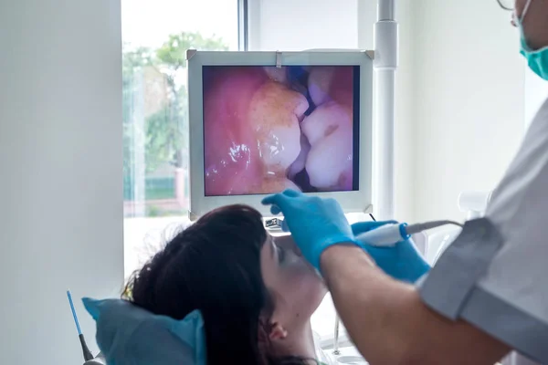 Dentysta używający aparatu pokazuje problemy zdrowotne. — Zdjęcie stockowe