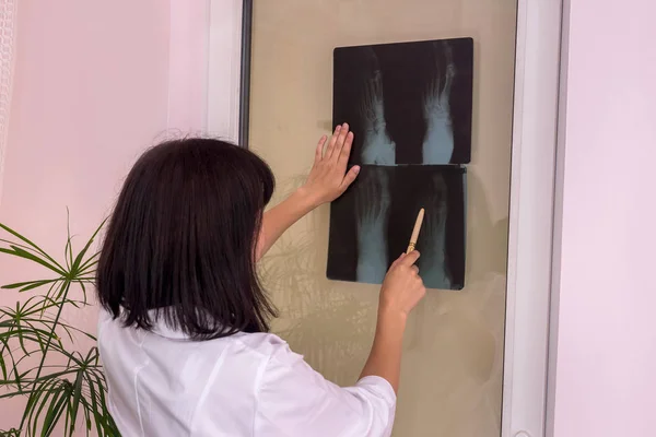 Doctor Apuntando Radiografía Del Pie Del Paciente —  Fotos de Stock