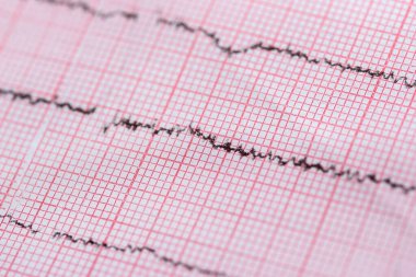 Arkaplan ve tıbbi tema olarak kullanılan kardiyogramı kapat