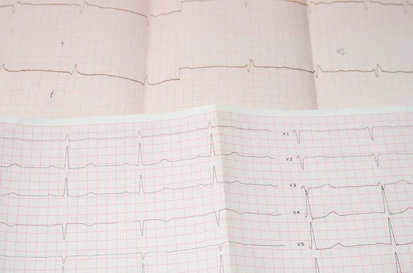 Cardiogram Grid — Stock Photo, Image