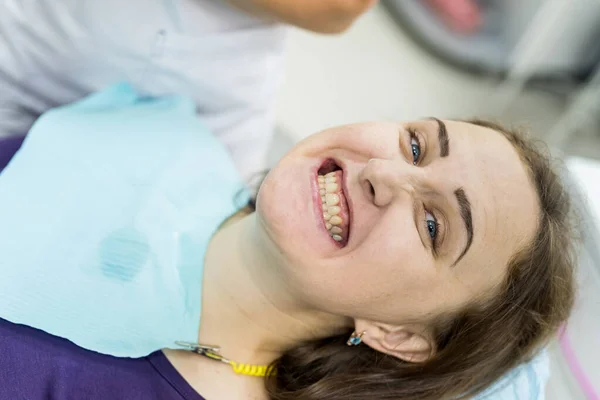 Femme Après Procédure Blanchiment Montrant Des Dents Dentisterie — Photo
