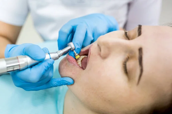 Полірування Зубів Пацієнта Після Процедури Відбілювання — стокове фото