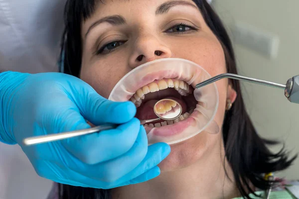 Manos Dentista Con Espejo Comprobando Los Dientes Del Paciente — Foto de Stock