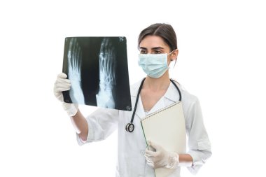 Hastanın röntgenini inceleyen doktor beyazı izole etti.