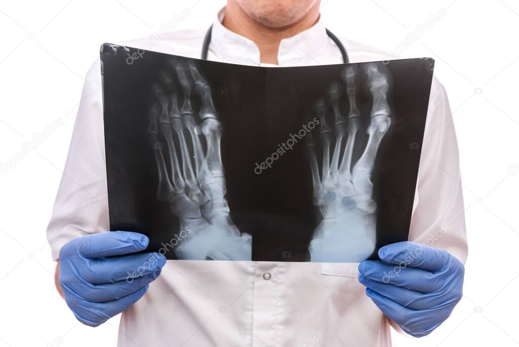 attractive doctor holding an foot x-ray. Examining X-ray.