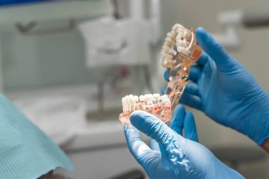 Diş hekimi çenesini implante edilmiş dişlerle sıkıca tutuyor.