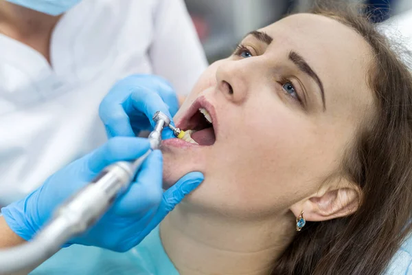 Odontólogo Pulir Los Dientes Del Paciente Después Del Procedimiento Blanqueamiento — Foto de Stock