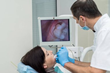 Doktor kamerayla hastanın dişlerini inceliyor.