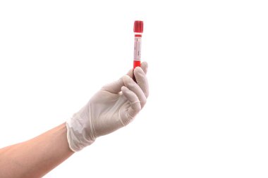 Koruyucu eldivenli bir erkek, beyaz üzerinde kan örnekleri bulunan bir tüp tutuyor.