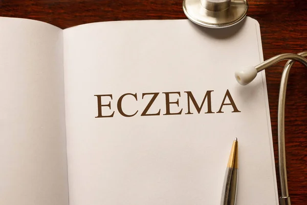 Pagina cu Eczema pe masă cu stetoscop, concept medical — Fotografie, imagine de stoc