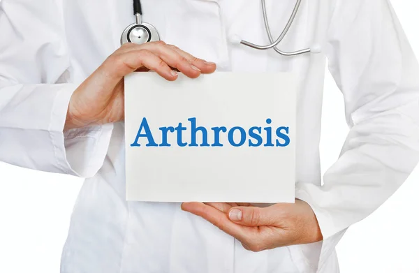 Cartão de artrose nas mãos do médico — Fotografia de Stock