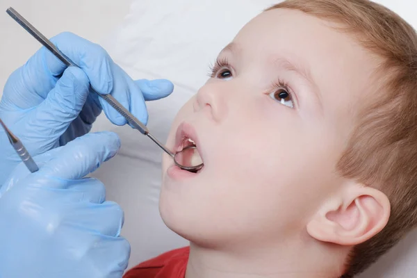 치과 의사에 의해 미러를 사용 하 여 자식 환자 치아의 의료 검사. 충 치, 치아 손상. — 스톡 사진