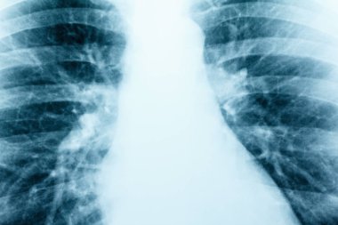 X-Ray görüntü, insan sağlıklı göğüs MRI yakın çekim