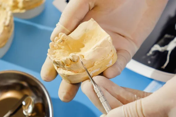 Zubní Zuby Čelist Zubař Zařízení Implantát Nástroj Zubní Lékařství — Stock fotografie