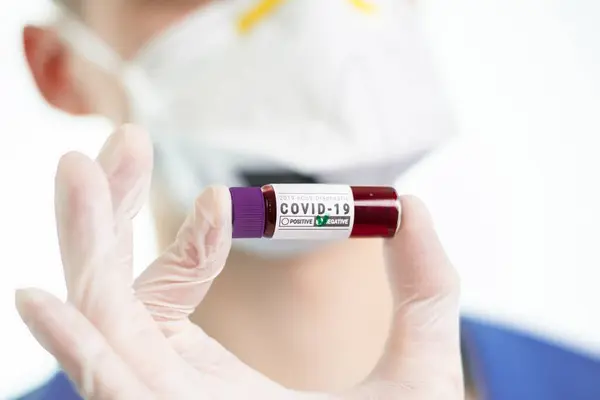 Coronavirus Kutató Laboratórium Orvos Vér Diagnosztikai Covid Betegség Corona Vírus — Stock Fotó