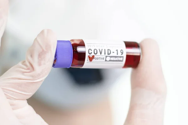 Laboratorio Investigación Del Coronavirus Doctor Con Diagnóstico Sangre Covid Italia — Foto de Stock