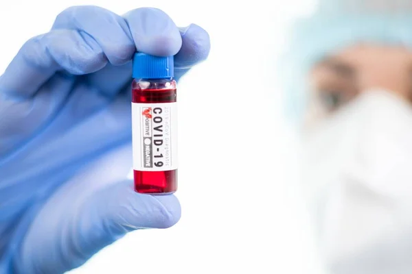 Лабораторія Досліджень Коронавірусу Лікар Діагностикою Крові Ковід Медична Клініка — стокове фото