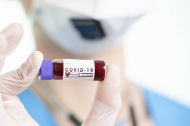Coronavirus araştırma laboratuvarı, kan teşhisi kovid 19 olan doktor, Corona virüsü..