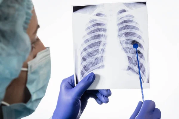 Radiographie Pulmonaire Covide Hôpital Médecin Coronavirus Infirmière — Photo
