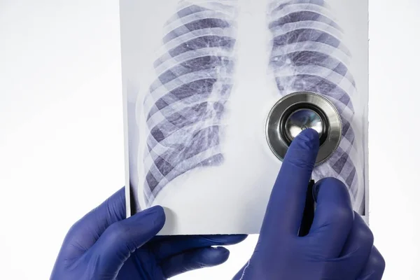Radiographie Pulmonaire Covide Hôpital Médecin Coronavirus Pandémie Santé — Photo
