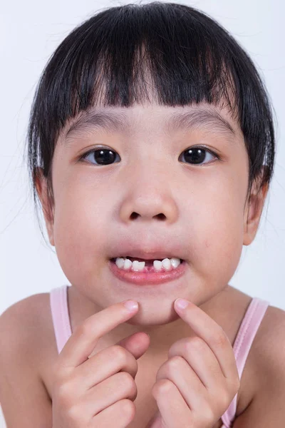 Китайський мало Підлітка пару користується показуючи її відсутній зуб — стокове фото