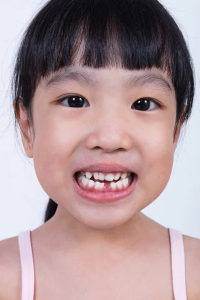 Asiatique chinois petite fille montrant sa dent manquante — Photo