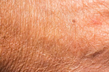 Cilt kırışıklıkları olgun erkek vücudunda ile doku