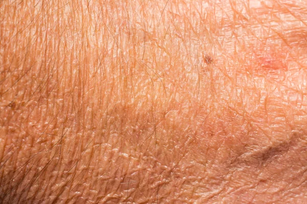 Textura da pele com rugas no corpo de macho maduro — Fotografia de Stock