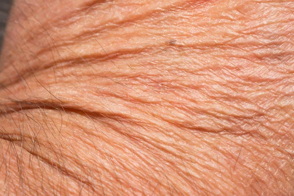 Texture of the skin with wrinkles on the body of mature male — Stock Photo, Image