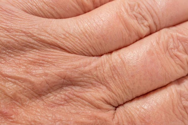 Texture of the skin with wrinkles on the body of mature male — Stock Photo, Image