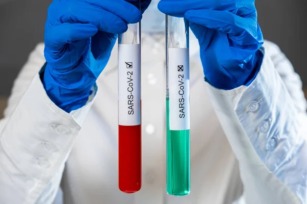 Positive and negative blood test results for SARS-CoV-2, coronavirus causing CONVID-19 disease