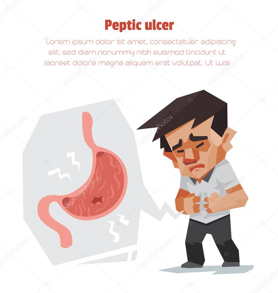 Peptic ulcer, Healthcare info graphic, Vector illustration. 
